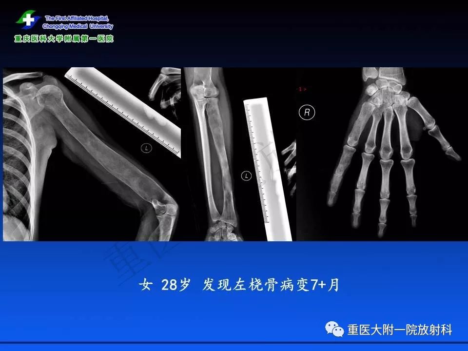 内裤超人幸福节大冒险